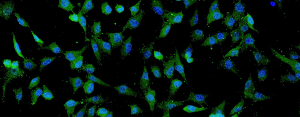 細(xì)胞外囊泡療法 癲癇治療的新希望